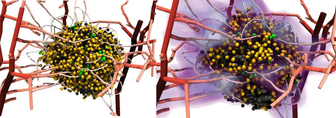 Final tumour before treatment (left) and at early stage of treatment (right)